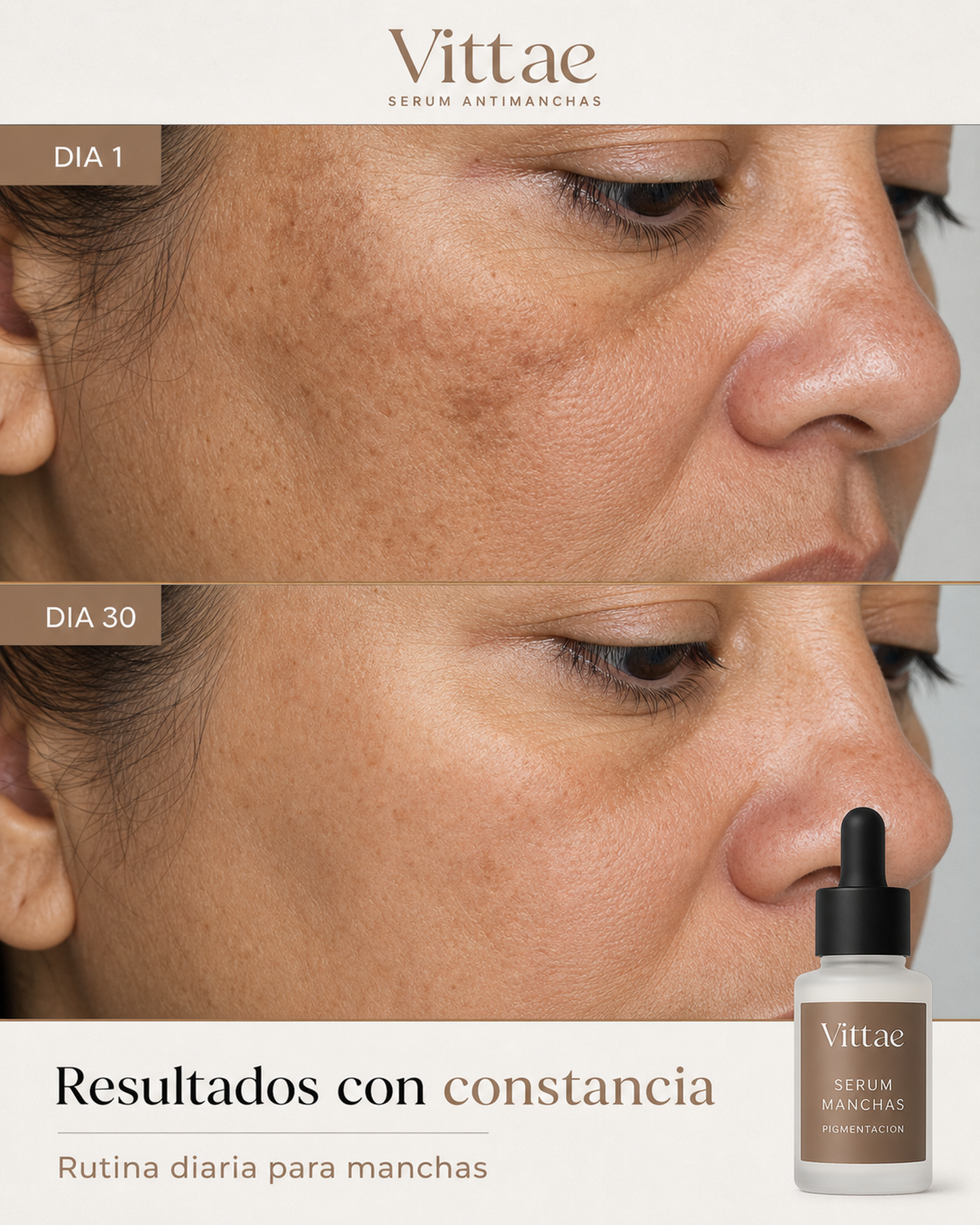 Vittae Serum Antimanchas dia 1 dia 30 melasma persona A 4:5