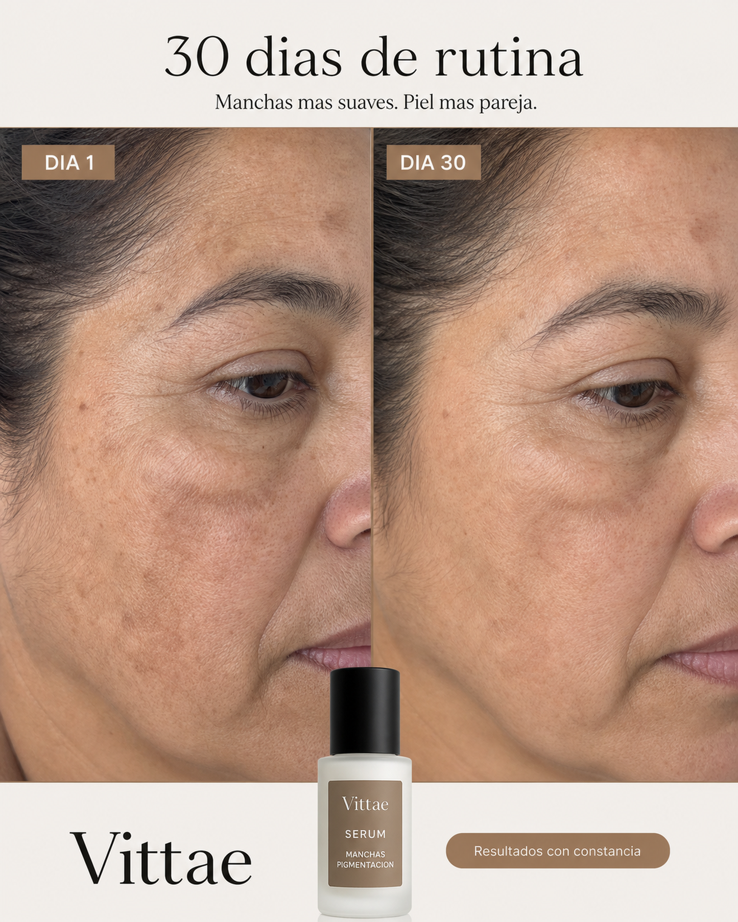 Vittae Serum Antimanchas dia 1 dia 30 melasma persona B 4:5