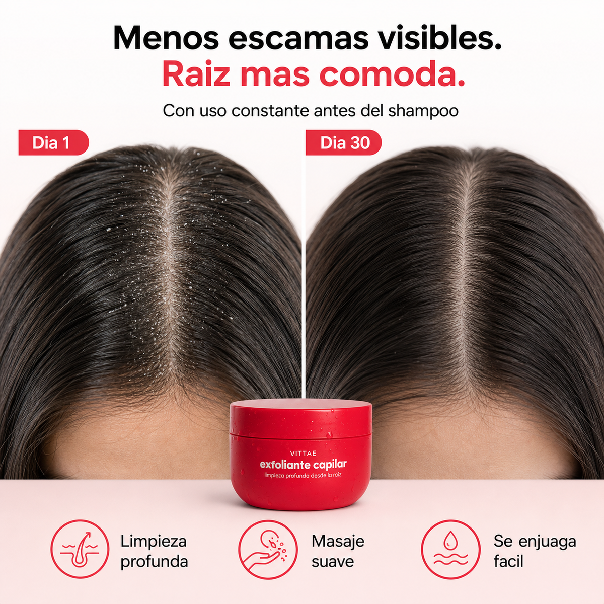 Vittae exfoliante capilar dia 1 dia 30 escamas visibles