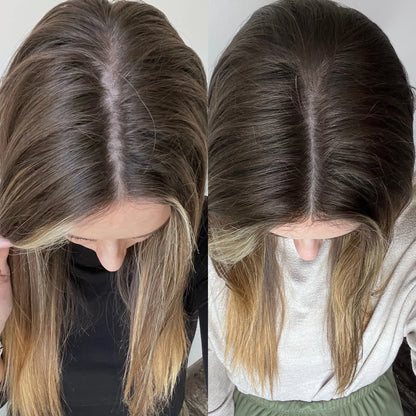 Vittae™ - Nutrición para el Pelo, Piel y Uñas